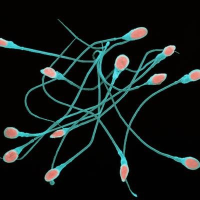 À travers le monde, la qualité du sperme connaît un déclin inquiétant