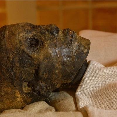 Cholestérol, malaria, dents gâtées : dans l'Égypte antique, personne n'échappait pas à la maladie