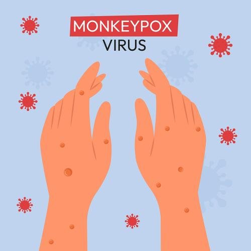 Cal/OSHA Issues Guidance on Protecting Workers From Monkeypox