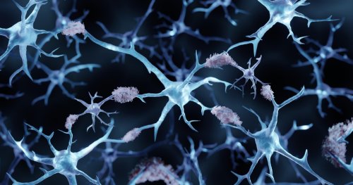 We’ve Reached an Inflection Point in Alzheimer’s Disease Care