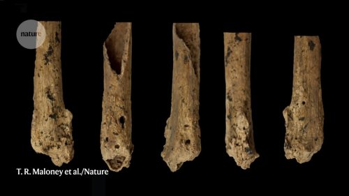 Prehistoric child’s amputation is oldest surgery of its kind