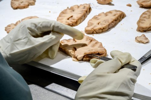 Madrid’s unique Alzheimer’s research hub reaches a pivotal moment