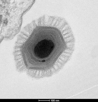 Newly Found Pandoraviruses Hint at a Fourth Branch of Life | Viruses101 | Learn Science at Scitable