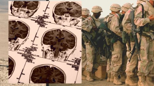 A Navy SEAL was convinced exposure to blasts damaged his brain, so he donated it to prove it