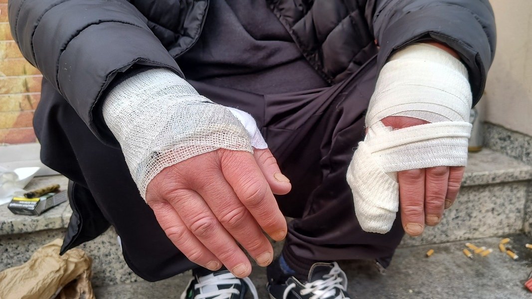 Brüche an Arm und Finger: Obdachloser Mensch in Göttingen verletzt