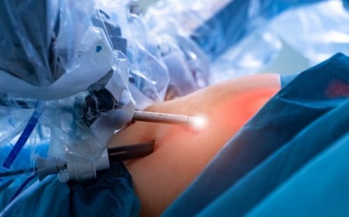 Robotic Surgery Is Safer and Improves Patient Recovery Time - Neuroscience News