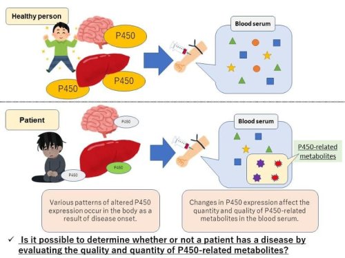 A Biomarker That Can Diagnose Parkinson’s Disease - Neuroscience News