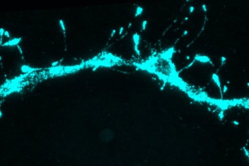 Silent Synapses Are Abundant in the Adult Brain - Neuroscience News