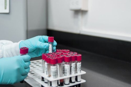 New Blood Test Can Detect ‘Toxic’ Protein Years Before Alzheimer’s Symptoms Emerge - Neuroscience News