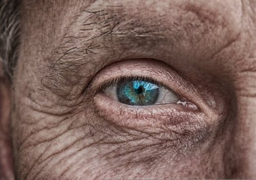 People With Glaucoma Are at Significant Risk of Alzheimer’s Disease - Neuroscience News