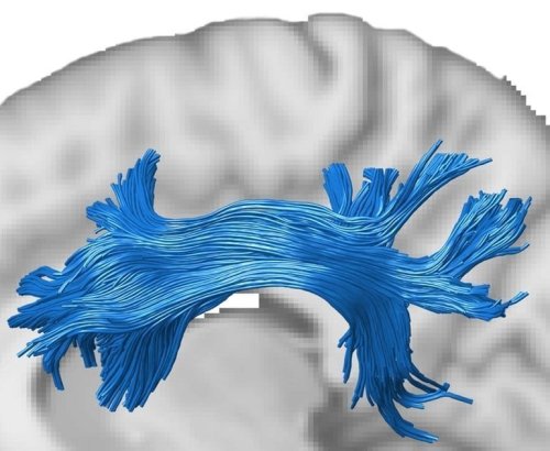 Using GPUs to Discover Human Brain Connectivity - Neuroscience News