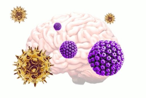 Chickenpox Virus May Trigger the Onset of Alzheimer’s Disease