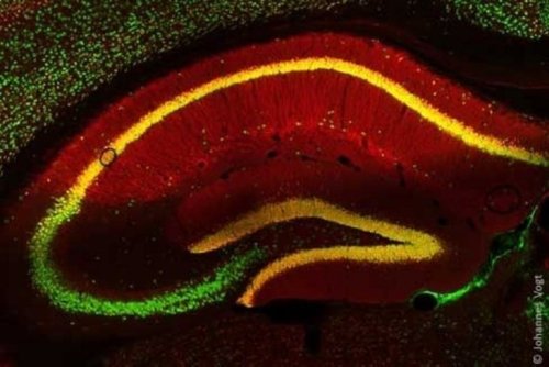 No More Binge Eating: Signal Pathway in the Brain That Controls Food Intake Discovered