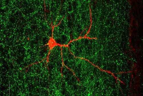 Autism-Linked Gene Found to Shape Nerve Connections - Neuroscience News