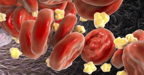 New & old drug combo drops cholesterol by 49% in human trial