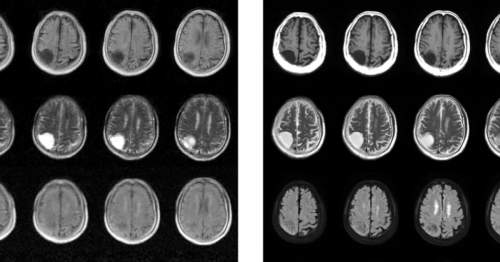 Mobile MRI machine detects brain disorders at a fraction of the cost