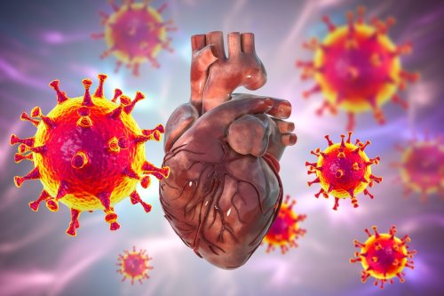 Heart problems surge in COVID patients up to 12 months after infection