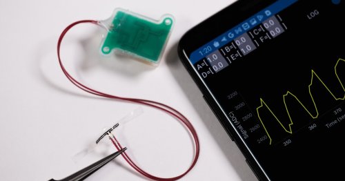 Bladder sensor sends "pee-time" alerts to patients' smartphones