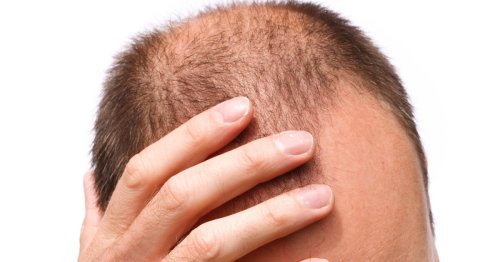 Baldness breakthroughs: The new science of hair regeneration