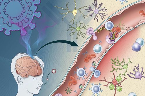 New clues to how COVID may trigger immune damage in the brain