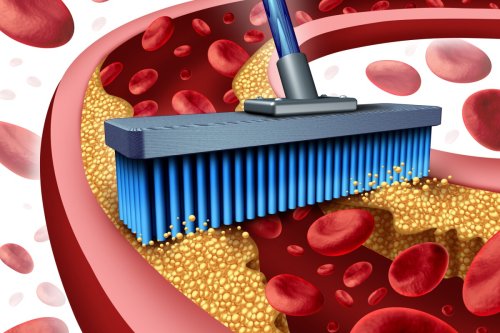 Oral pill cuts bad cholesterol by 60% in phase 2 clinical trial