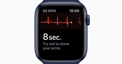 AI algorithm detects asymptomatic heart disease from Apple Watch ECG data
