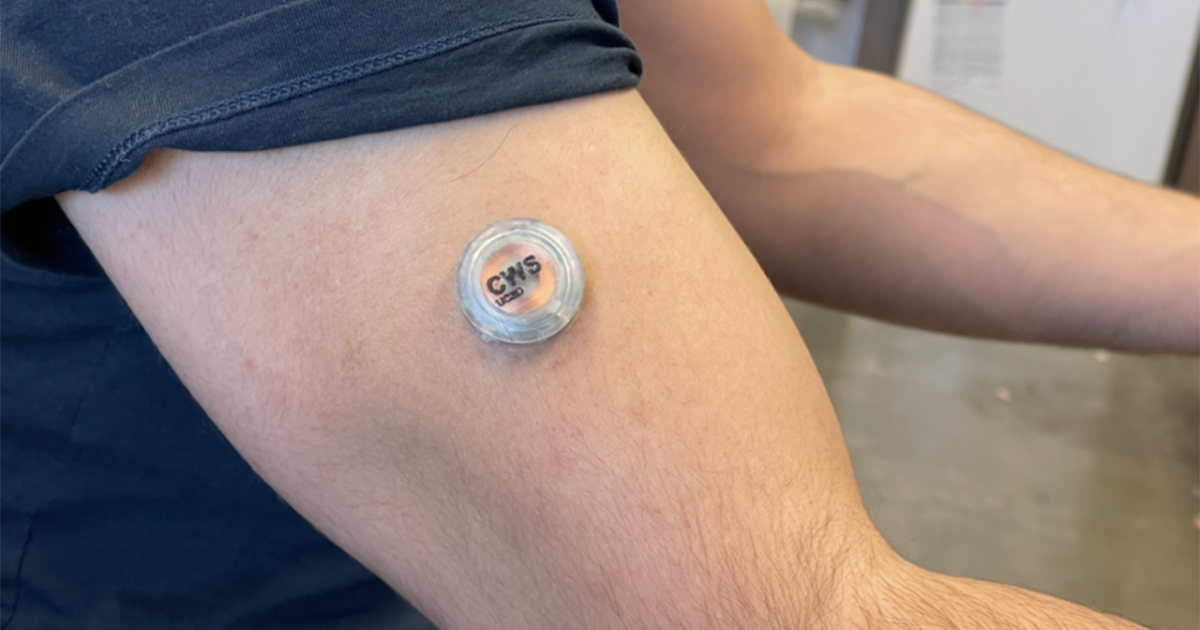 Wearable simultaneously measures alcohol, lactate and glucose levels