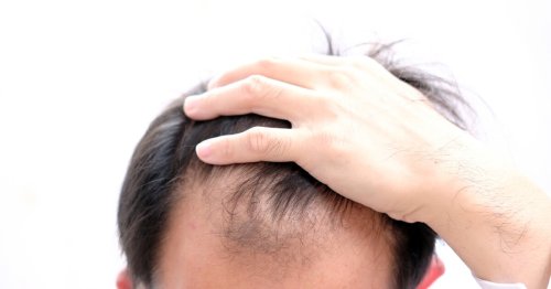 Hair-loss breakthrough found in keratin microspheres