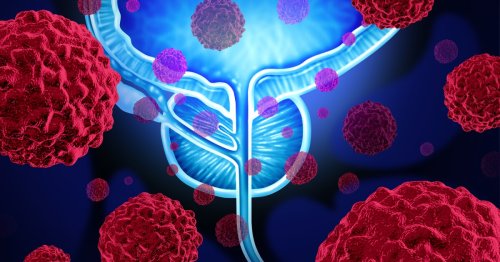 Newly identified prostate cancer subtypes suggest new treatment options