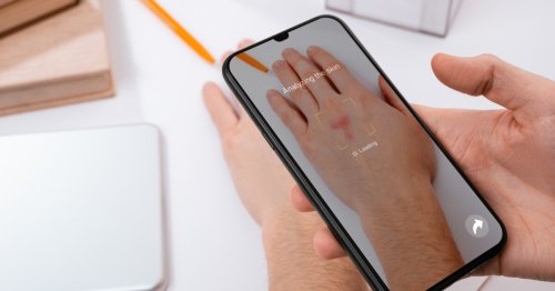 You can now use your phone to ID skin conditions
