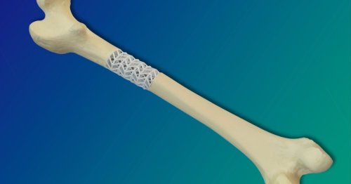 Implantable composite designed to fill and heal broken bones