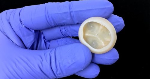 3D bioprinting breakthrough leads to full-scale, functioning heart parts