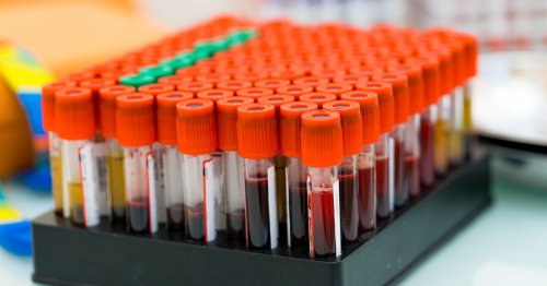 Blood biomarker promises to identify diabetes before symptoms develop