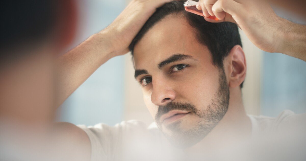 Maintaining stem cell stickiness could be the key to battling baldness