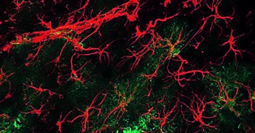 Natural molecule reverses age- and dementia-related cognitive decline