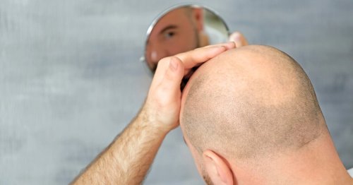 Stopping hair loss may be as easy as boosting this "bodyguard" protein