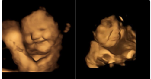 Incredible study images babies responding to taste of kale in the womb