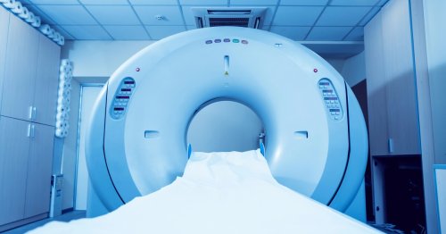 CT scans and cancer risk: What you need to know
