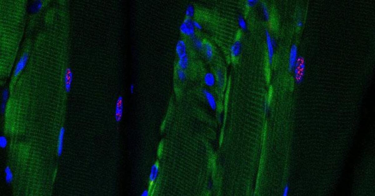 CRISPR gene-editing tool tweaked to tackle muscular dystrophy via RNA
