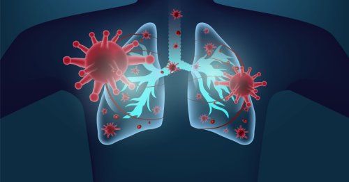 New COVID variants better infect lungs, could cause more severe disease