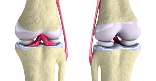 Hybrid 3D-printing bioinks help repair damaged knee cartilage