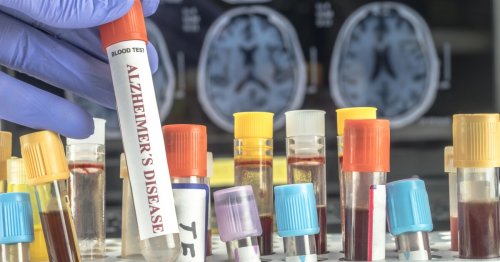 Breakthrough Alzheimer's blood test has been approved for the US
