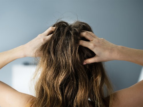 Dermatologists Sound Off on Topical Finasteride After FDA Alert - NewBeauty