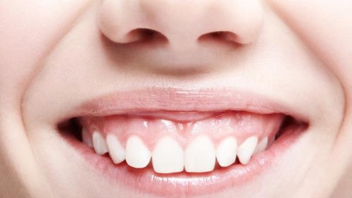Kurioses aus Wales: Nach Horror-Unfall! Kind (13) wachsen Zähne in der Nase