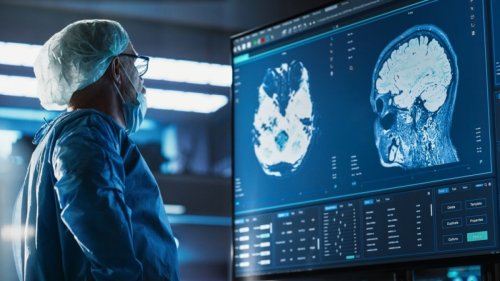 Brandenburgs Kliniken im Vergleich Mai 2025: Wie schneiden sie bei Neurologiebehandlungen ab?