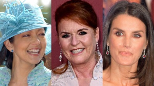 Von Meghan Markle bis Königin Letizia: Diese Royals-Damen lagen schon beim Beauty-Doc unterm Messer