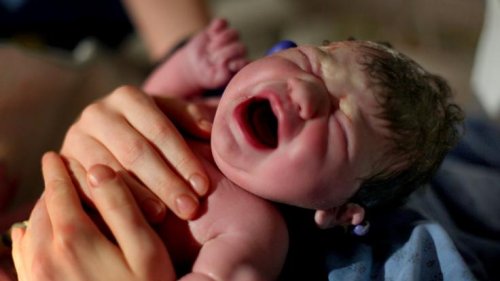 Schock-Geburt in Indien: Frau bringt Baby mit vier Armen und vier Beinen zur Welt