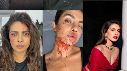 Priyanka Chopra Shares Blood-stained Selfies, Says ‘ready To Do This 