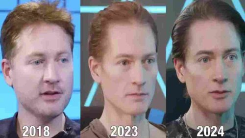 Billionaire Businessman’s Age-Defying Journey: Transforming Youthfully Over 6 Years Stuns The World