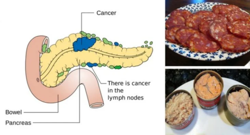 10 Cancer-Causing Foods You Should Never Put In Your Mouth Again